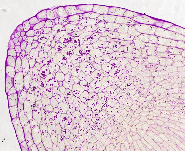 células vegetais vistas com microscópio